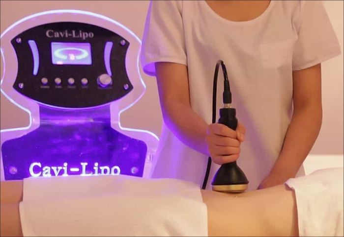 Cavi-Lipo Stockholm | Beauty By Betty